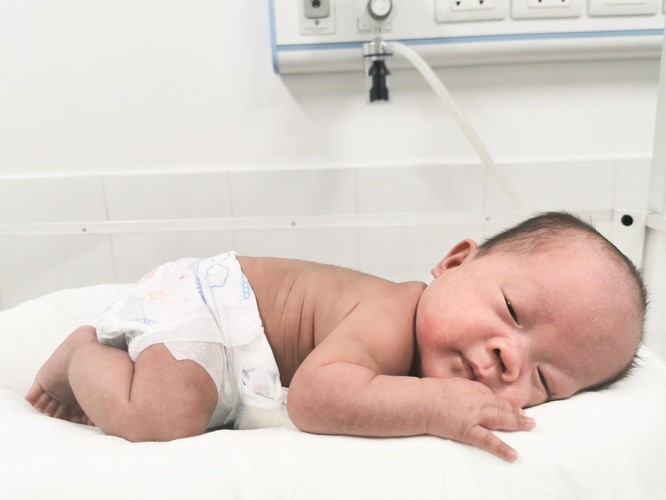 Cứu sống bé sinh non bị suy hô hấp chỉ nặng 750g  - ảnh 2