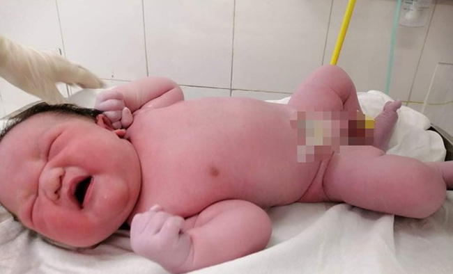 Bé trai sơ sinh nặng 5390g chào đời tại Bệnh viện Phụ Sản Hà Nội - Ảnh 1.