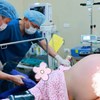 Ca mổ lấy thai đầy thách thức: Mẹ nặng 150 kg, đa ối gần 5 lít, bé trai chào đời nặng 5,4 kg