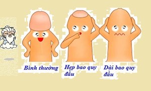 Hẹp bao quy đầu - những điều cần biết