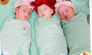 Bệnh viện Phụ Sản Hà Nội mổ đẻ an toàn ca sinh 3 tự nhiên cùng trứng vô cùng hiếm gặp