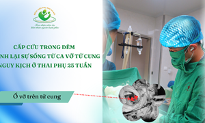 Cấp cứu trong đêm: Giành lại sự sống từ ca vỡ tử cung nguy kịch ở thai phụ 25 tuần