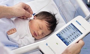 Cần thiết phải sàng lọc thính lực cho trẻ sau sinh