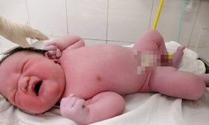 Bé sơ sinh nặng gần 5.4kg chào đời ở Hà Nội