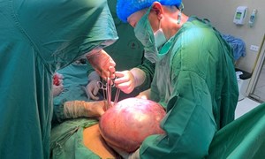 Phẫu thuật thành công khối u buồng trứng khổng lồ nặng 7kg cho nữ bệnh nhân