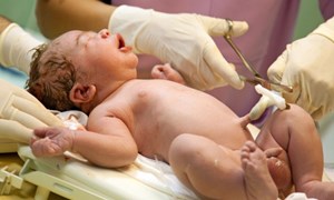 Việc cắt dây rốn chậm cho trẻ sơ sinh có thật sự tốt cho sức khỏe?