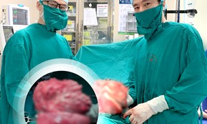 Phẫu thuật lấy khối u xơ tử cung nặng 3kg tại khoa Phụ Nội tiết A1