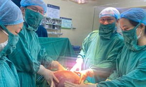 Khối U buồng trứng không lồ 30cm nặng 4,5kg