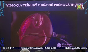 (HanoiTV) Bệnh viện Phụ sản Hà Nội làm chủ kỹ thuật laser quang đông trong Y học bào thai