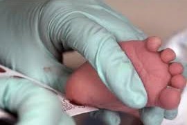 Nguyên tắc sàng lọc sơ sinh và kỹ thuật lấy máu gót chân