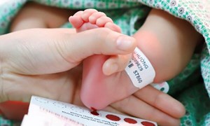 Lấy máu gót chân điều trị bệnh lý di truyền cho trẻ