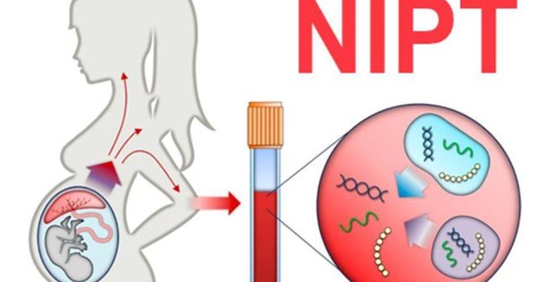 Có những yếu tố nào ảnh hưởng đến thời điểm thích hợp để xét nghiệm NIPT?
