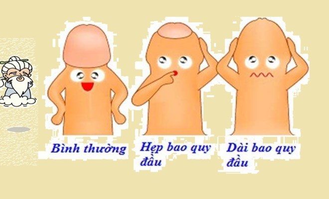 Hẹp bao quy đầu - những điều cần biết