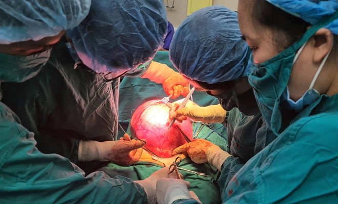 Phẫu thuật thành công bệnh nhân có khối u xơ xơ tử cung nặng 6,9kg