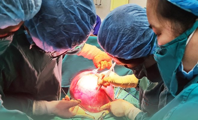 Hà Nội phát hiện khối u nặng gần 7kg trong cơ thể người phụ nữ ở quận Hoàn Kiếm