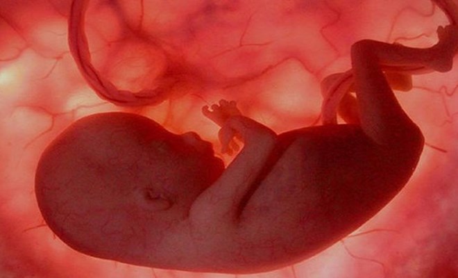Mẹ bầu cần làm để tránh dị tật thai trong thai?