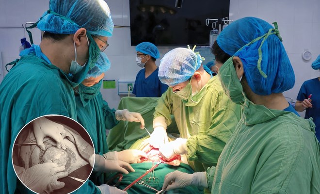 KHI NGUY CƠ CỦA MẸ VÀ CỦA THAI NHI CÙNG HIỆN DIỆN: THÁCH THỨC CHỒNG THÁCH THỨC TRONG MỘT THAI KỲ