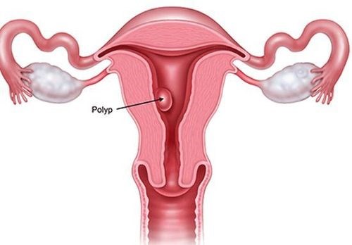 Rong kinh kéo dài, người phụ nữ nhập viện trong tình trạng kiệt sức