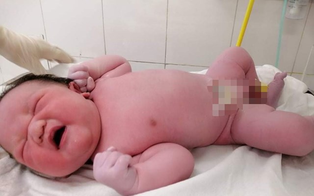 Bé trai sơ sinh nặng 5390g chào đời tại Bệnh viện Phụ Sản Hà Nội