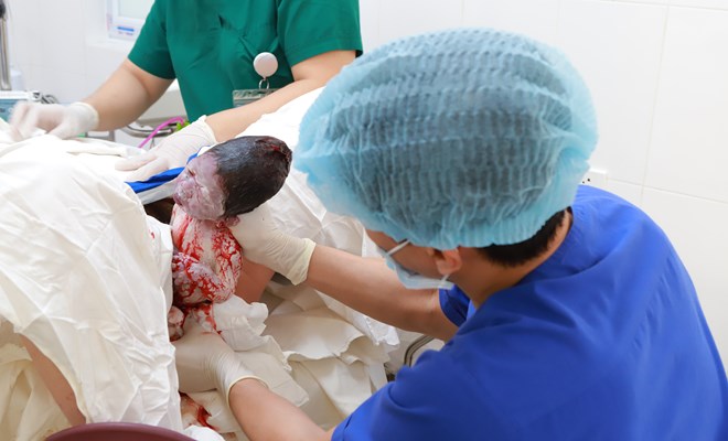 Vì sao đôi lúc bác sĩ cần can thiệp khi sinh thường?