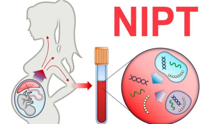 NIPT: Phương pháp phát hiện sớm dị tật thai nhi