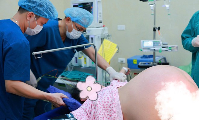 Ca mổ lấy thai đầy thách thức: Mẹ nặng 150 kg, đa ối gần 5 lít, bé trai chào đời nặng 5,4 kg