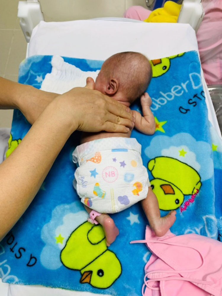 Sự sống kỳ diệu của các bé sinh non, có tuổi thai và cân nặng nhỏ nhất Việt Nam- Ảnh 2.
